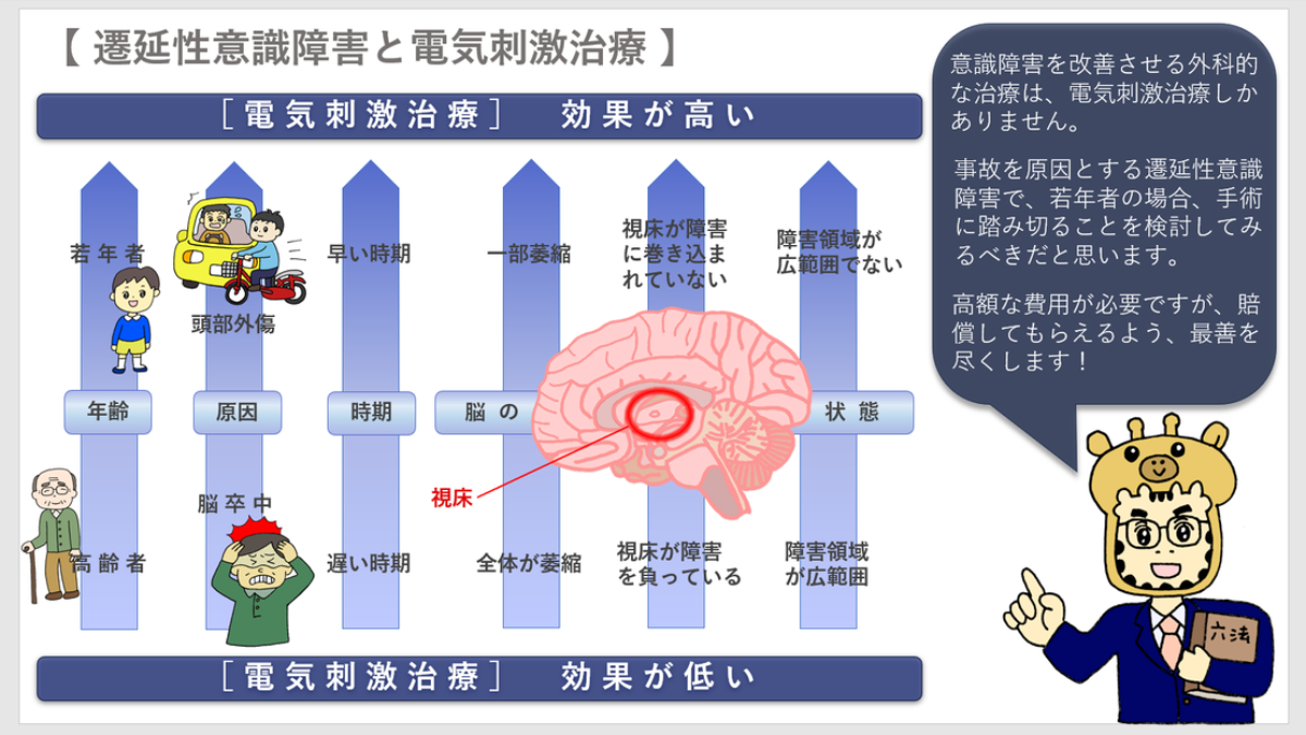 遷延性意識障害②（電気刺激治療） - 交通事故コラム キリン先生の交通