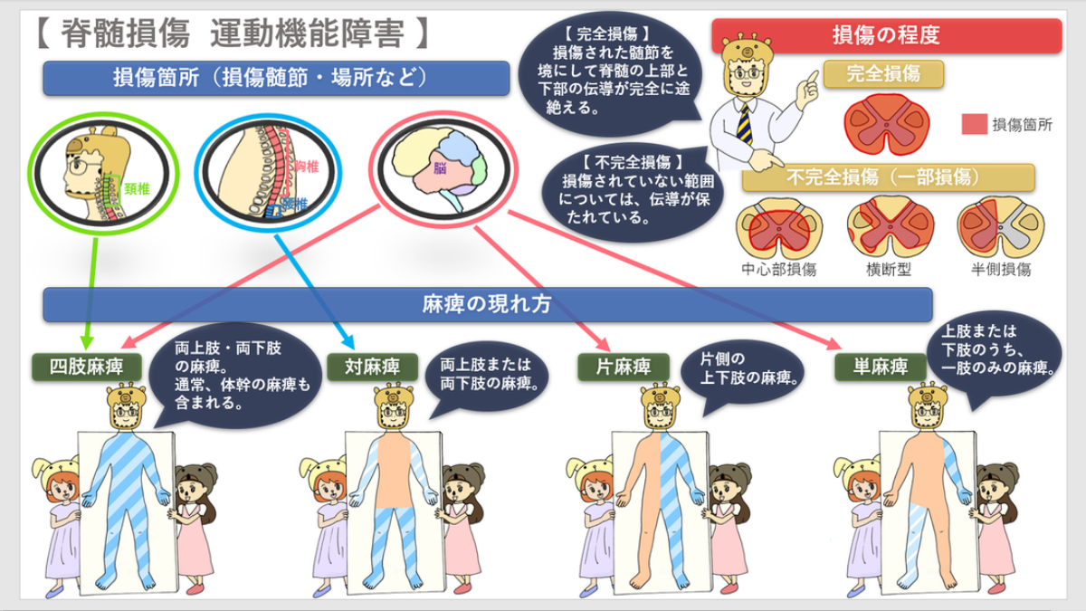 脊髄損傷③（運動機能障害） | 交通事故コラム キリン先生の交通事故