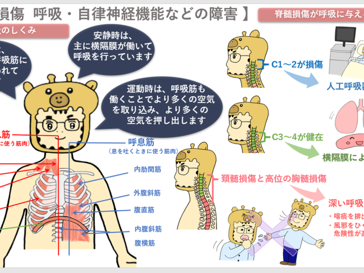 脊髄損傷⑤（呼吸・自律神経機能などの障害） - 交通事故コラム キリン