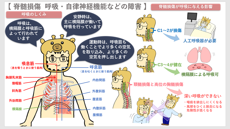 脊髄損傷⑤（呼吸・自律神経機能などの障害） - 交通事故コラム キリン